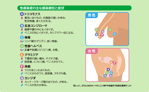 エイズを予防しよう Hiv早期発見でエイズを防ぐ